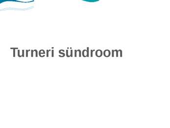 Turneri sündroom