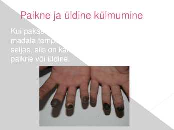 Kehaosade külmumine ja kuumenemine-tagajärjed #7