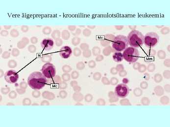 Vereloome e-hemopoees #13