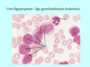 Vereloome e-hemopoees #14