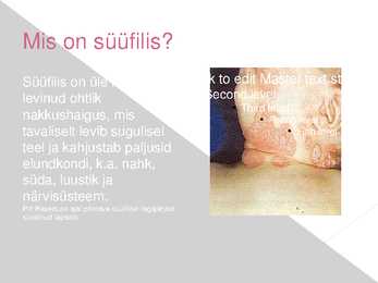 Süüfilis #2