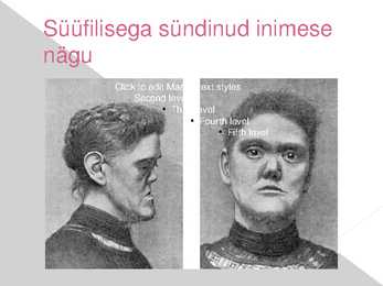 Süüfilis #13