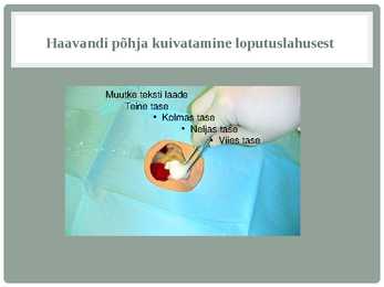 HAAVA ja haavandi hindamine #29