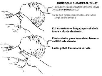 Kui on vaja elustada #7