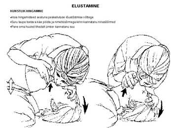 Kui on vaja elustada #8