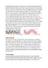 Laserid #2
