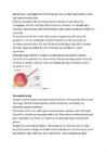 Laserid #3