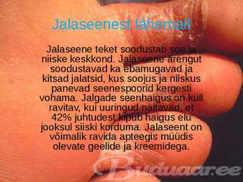 Inimeste parasiitseened #4