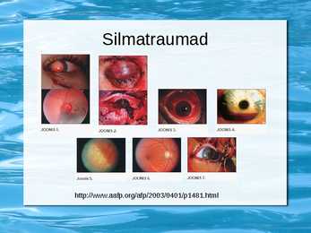 Silmalihaste treenimine #22