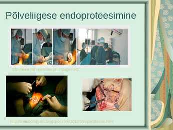 PÕLVELIIGESE ARTROOSIGA PATSIENT #10