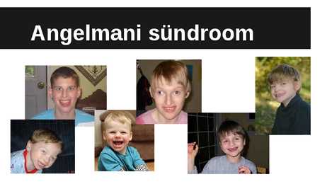 Angelmani sündroom #12
