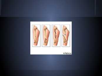 Sports injuries #12