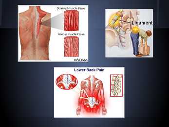 Sports injuries #6