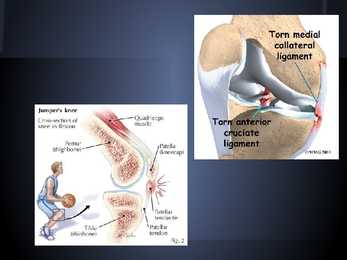 Sports injuries #9
