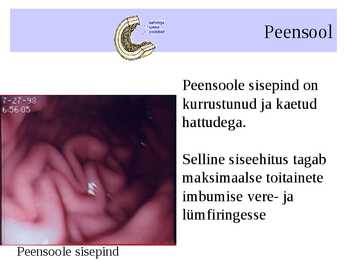 Seedeelundkond #14