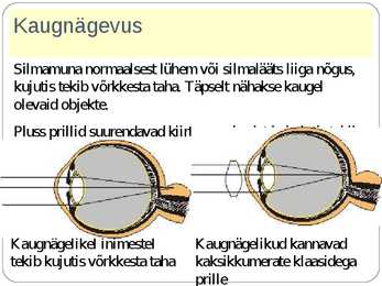 SILM JA NÄGEMINE #11