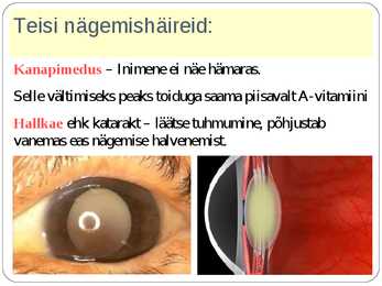 SILM JA NÄGEMINE #14