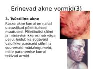 Lokaalselt nahale kasutatavad akne ravimid #7