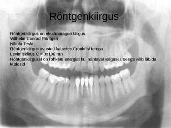 Röntgenkiirgus #3