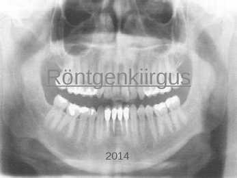 Röntgenkiirgus