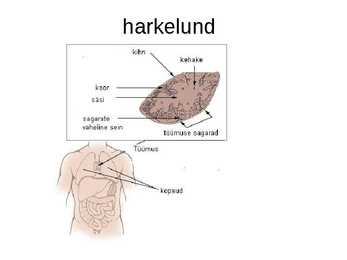 Endokriinnäärmed e-sisenõrenäärmed #15