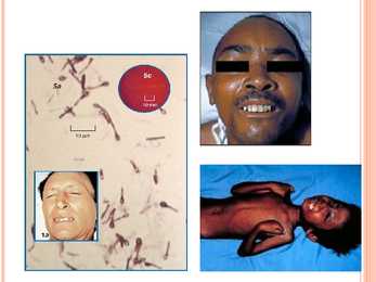 Clostridium Tetani #7
