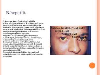 Hepatiit #4