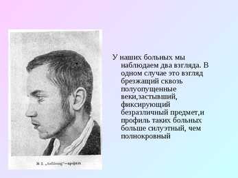 Skisofreenia - Geenetika #14