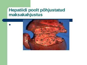 SUGULISEL TEEL LEVIVAD HAIGUSED #9