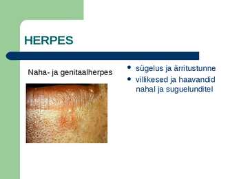 SUGULISEL TEEL LEVIVAD HAIGUSED #10