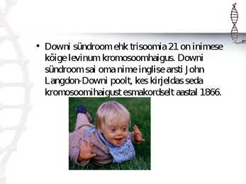 Downi sündroom #2