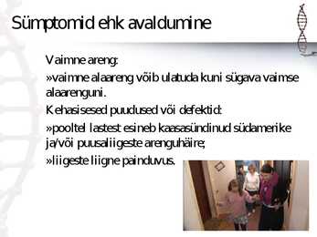 Downi sündroom #6