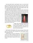 Pulmad #4