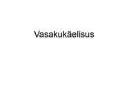 Vasakukäelisus