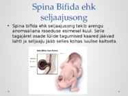 Seljaajusonga ja vesipeasust ennetavad toidulisandid #2