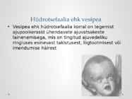 Seljaajusonga ja vesipeasust ennetavad toidulisandid #3