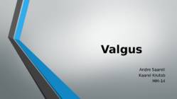 Valgus
