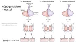 Suguhormoonide ala- ja ületalitluse etiopatogenees #17
