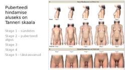 Suguhormoonide ala- ja ületalitluse etiopatogenees #9