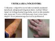 LAPSE HOOLDAMINE SÜGELEVATE LÖÖVETE VÕI LIHTSALT NAHA SÜGELEMISE KORRAL #13