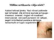 LAPSE HOOLDAMINE SÜGELEVATE LÖÖVETE VÕI LIHTSALT NAHA SÜGELEMISE KORRAL #14