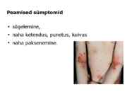 LAPSE HOOLDAMINE SÜGELEVATE LÖÖVETE VÕI LIHTSALT NAHA SÜGELEMISE KORRAL #9