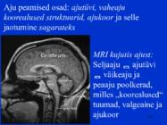 Sissejuhatus psüühikasse #107