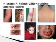 Bioaktiivsed amiinid-Histamiin #6