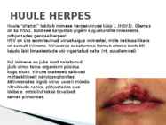 Herpes ja Haigused #3
