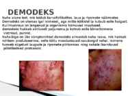 Herpes ja Haigused #21
