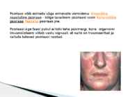 Herpes ja Haigused #25