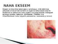Herpes ja Haigused #8