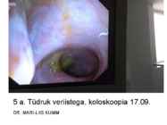 Seedeelundite haigused #2
