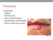 Herpes ehk ohatis esitlus #2